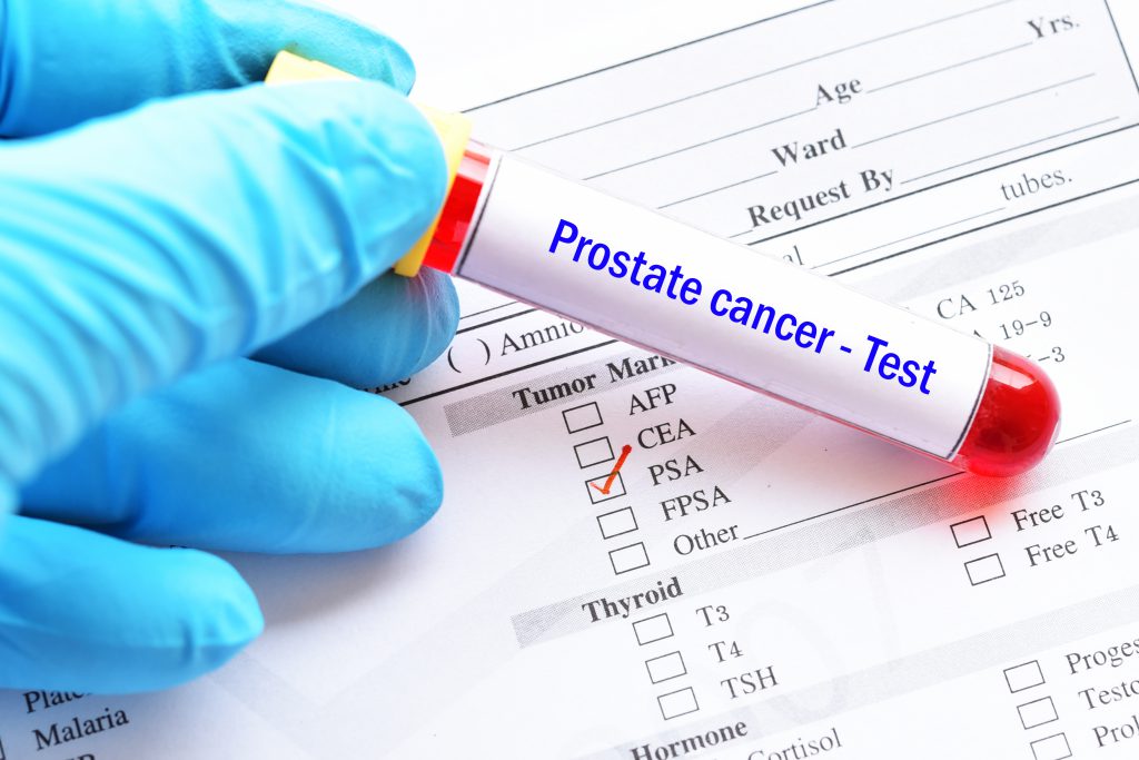 The Test Detected Cancers That Are Typically Found At Much Later Stages